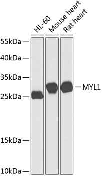 MYL1 Rabbit Polyclonal Antibod