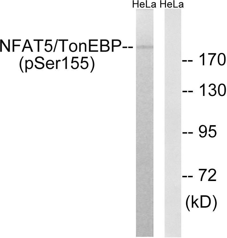 NFAT5/TonEBP (Phospho-Ser155)