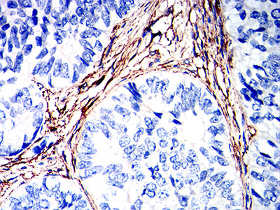 TMEM119 Mouse mAb[64328]