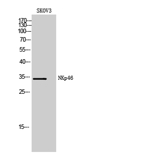NKp46 Polyclonal Antibody[4198