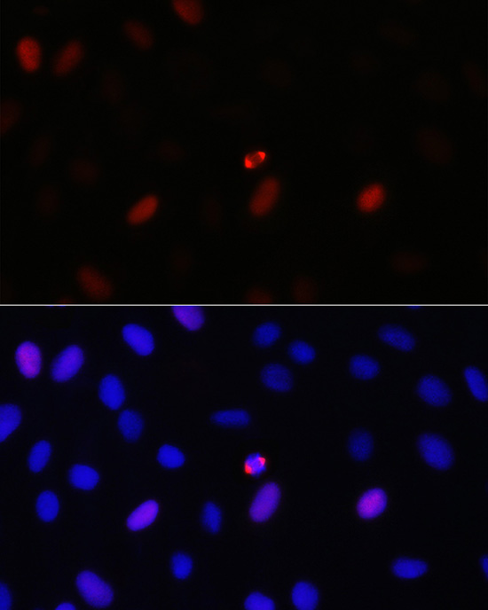 TPX2 Rabbit Polyclonal Antibod
