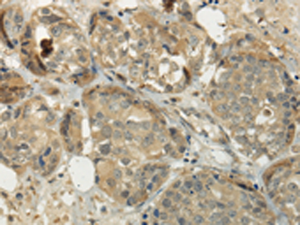 SIAH1 Antibody[43329]