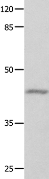 GNA11 Antibody[35744]