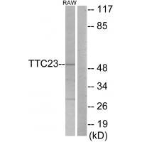 TTC23 Antibody[33931]