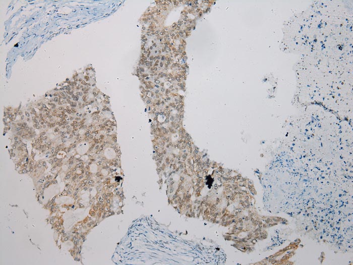 SMYD2 Antibody[43434]
