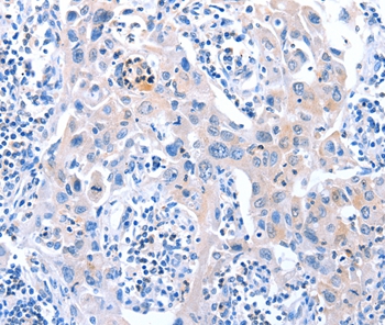 ACAD11 Antibody[36016]