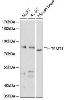TRMT1 Rabbit Polyclonal Antibo