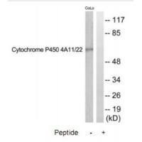 Cytochrome P450 4A11/22 Antibo