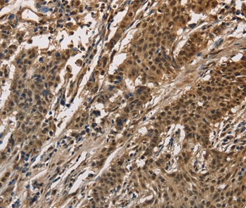 CCAR1 Antibody[36417]