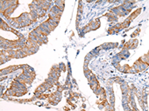 KRT7 Antibody[43217]