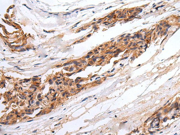 GABRR2 Antibody[43672]