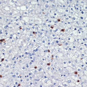 S100A8 Polyclonal Antibody[292