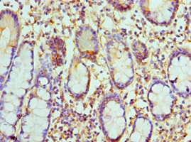 CCL8 Polyclonal Antibody[42106