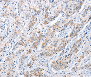 PAPSS1 Antibody[36177]