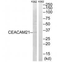 CEACAM21 Antibody[34553]