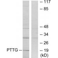 PTTG Antibody[33817]