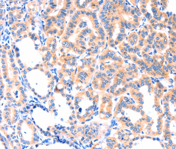 THBS1 Antibody[37384]