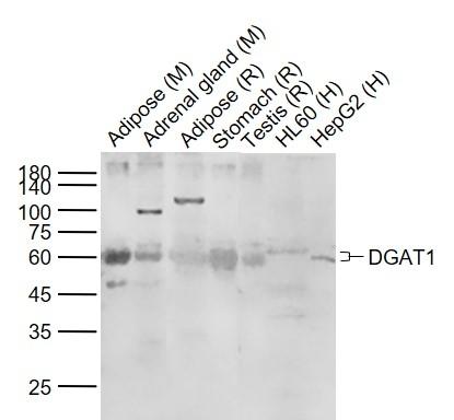 DGAT1 Antibody[37532]