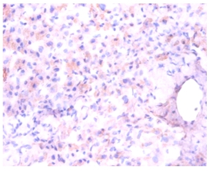 Aspartate aminotransferase, mi