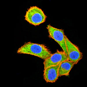 TLT2 Mouse mAb[64327]