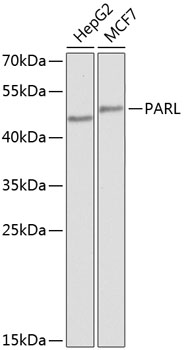 PARL Rabbit Polyclonal Antibod