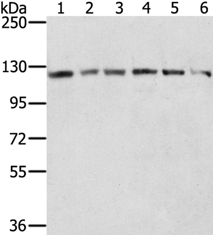 RNF20 Antibody[40080]