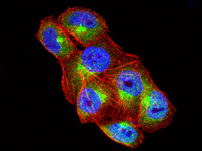 HSP70 Mouse mAb[63751]