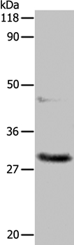 APIP Antibody[35591]