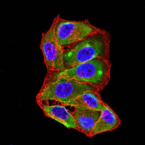 TNFSF11 Mouse mAb[64341]
