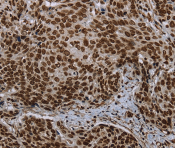 LEO1 Antibody[37702]