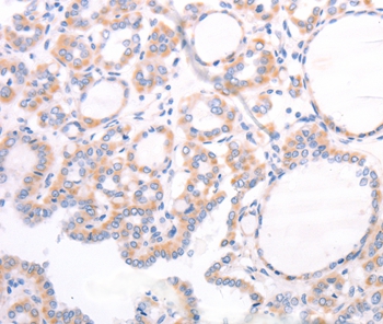 TRPC7 Antibody[35976]