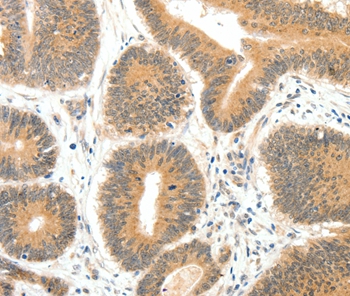 SERPINE1 Antibody[35861]