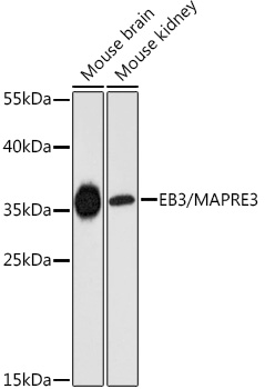 MAPRE3 Rabbit Polyclonal Antib