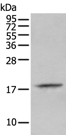 PRH2 Antibody[43931]