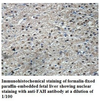 FAH Antibody[39846]