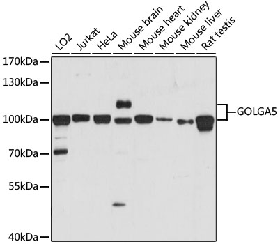 GOLGA5 Rabbit Polyclonal Antib