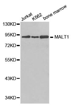 MALT1 antibody[38381]