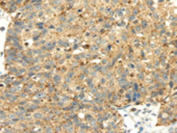 SENP2 Antibody[42749]