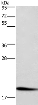 CFL1 Antibody[36360]
