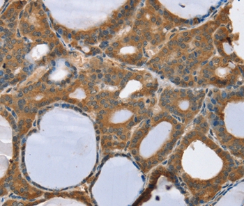 TRIM3 Antibody[37876]