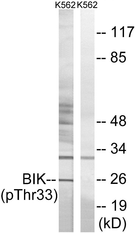 BIK (Phospho-Thr33) Antibody[1