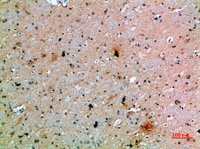 PDGF-C Polyclonal Antibody[468