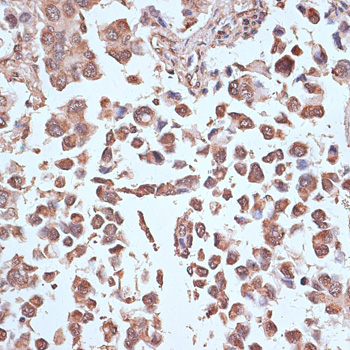 NFE2L1 Polyclonal Antibody[291