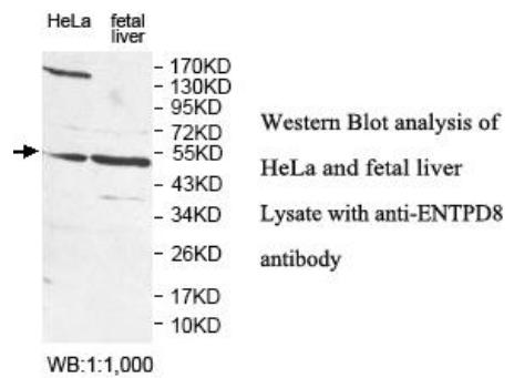 ENTPD8 Antibody[40051]
