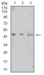 LTBR Mouse mAb[63890]