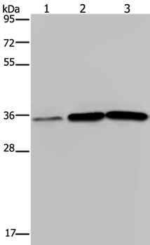 MAGEA3 Antibody[37138]