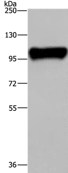 PTK2B Antibody[36460]