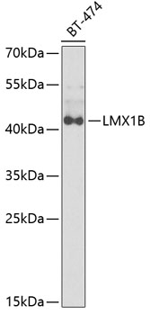 LMX1B Rabbit Polyclonal Antibo