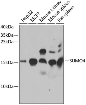 SUMO4 Rabbit Polyclonal Antibo