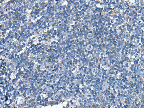UFC1 Antibody[43612]